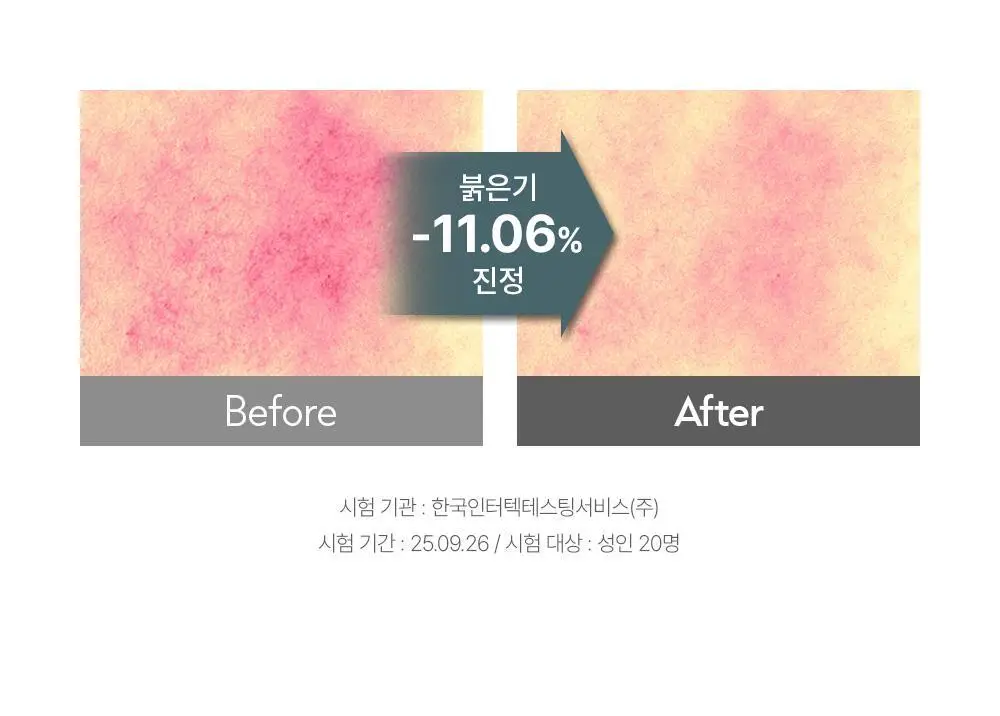 [초간편 진정 패드] 오브제 맥스 이지 픽 토너 패드 60매 상세페이지 26